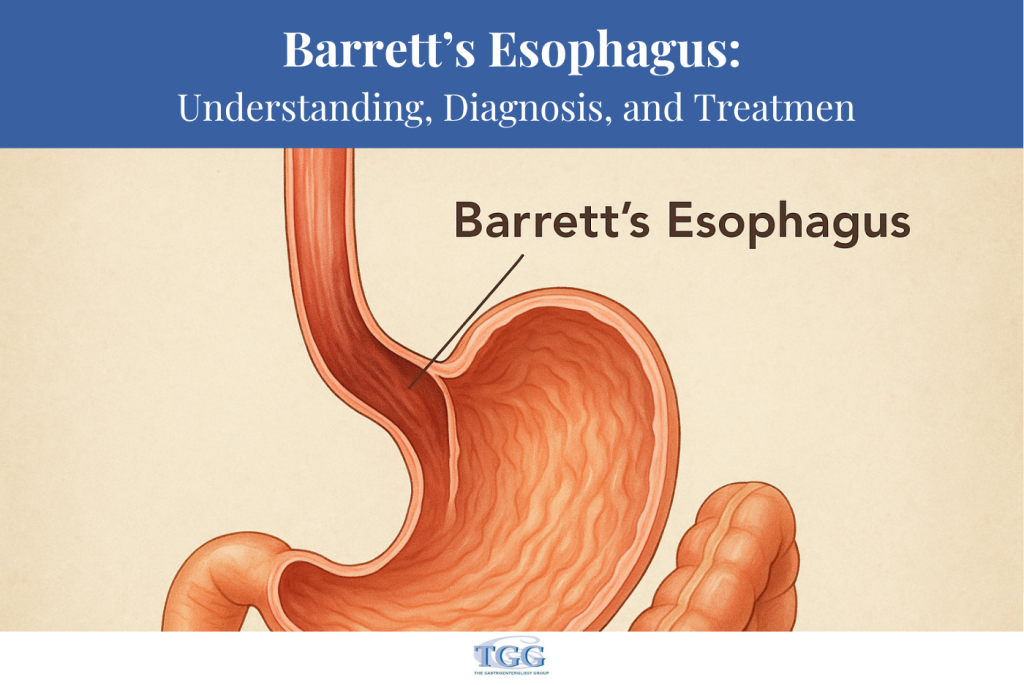 Barrett’s Esophagus Understanding, Diagnosis, and Treatment